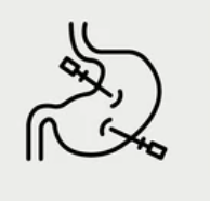 Laparoscopic Surgery